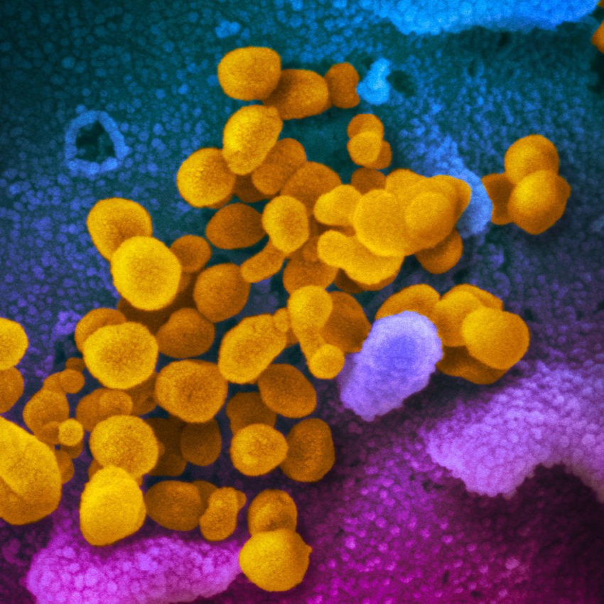 Coronavirus COVID-19 disease 2019: A  guide.